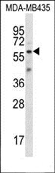 FSCN3 antibody