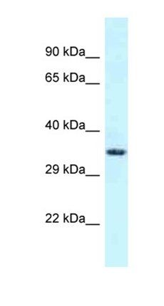 FSD1L antibody