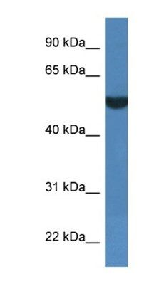 FSD1L antibody