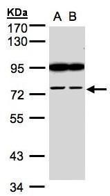 FSD2 Rabbit Polyclonal Antibody