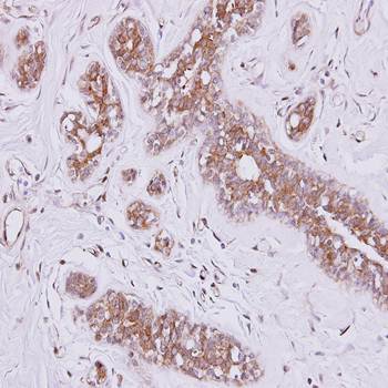 fibronectin type III and SPRY domain containing 2 antibody