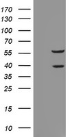 FSH beta (FSHB) antibody