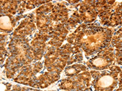 FSHR Antibody