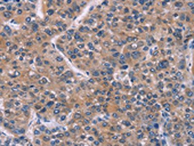 FST Antibody