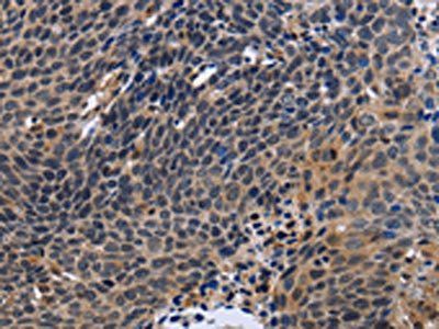 FSTL1 antibody