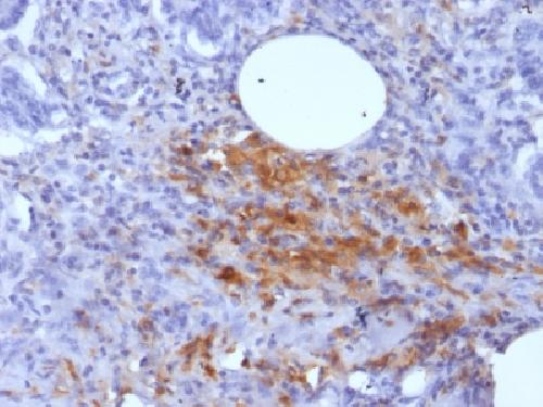 FTL Antibody