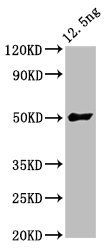 FTL3 antibody