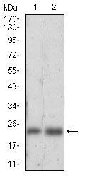 FTL Antibody