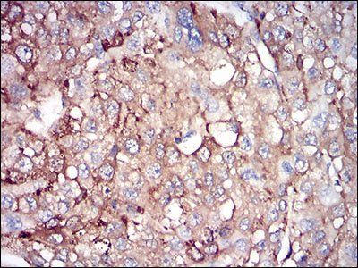 FTL Antibody