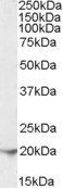 Ferritin antibody