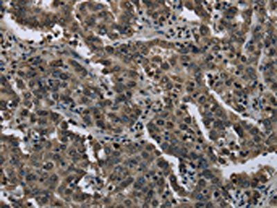 FTO Antibody