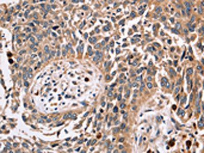 FUCA1 Antibody