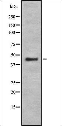 FucT-IV antibody