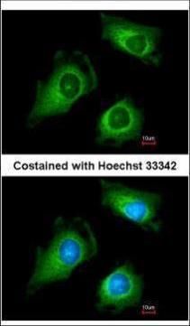 Fukutin Rabbit Polyclonal Antibody