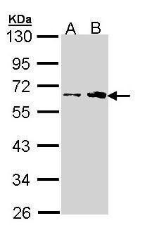 Fukutin Rabbit Polyclonal Antibody
