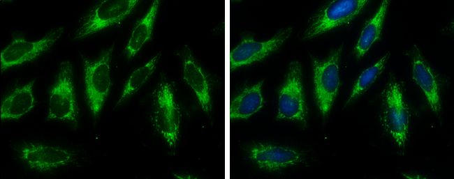 Fumarate hydratase Rabbit Polyclonal Antibody