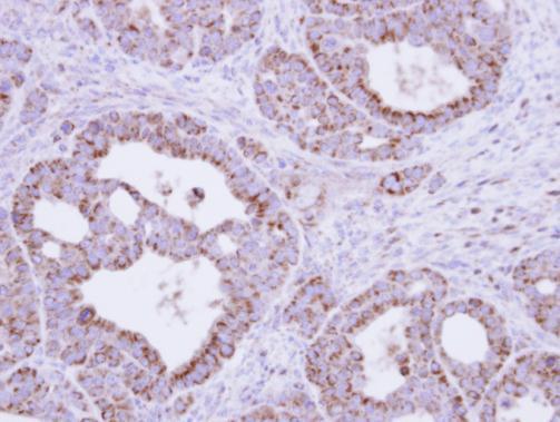 Fumarate hydratase Rabbit Polyclonal Antibody