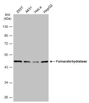 Fumarate hydratase Rabbit Polyclonal Antibody