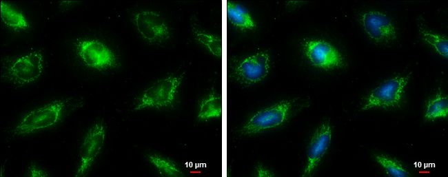 Fumarate hydratase Rabbit Polyclonal Antibody