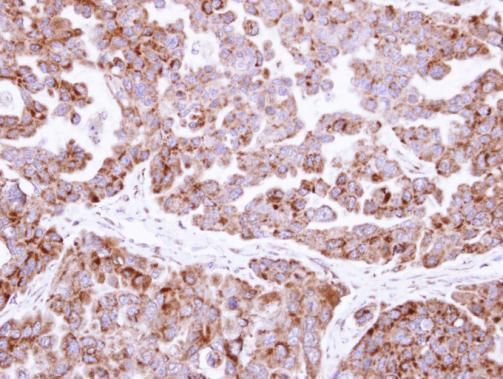 Fumarate hydratase Rabbit Polyclonal Antibody