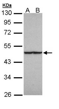 fumarate hydratase antibody