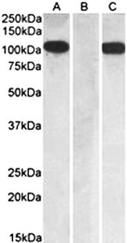 Goat anti-FURIN / PCSK3 Antibody