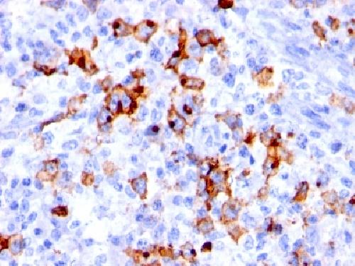 CD15 / FUT4 (Reed-Sternberg Cell Marker) Antibody