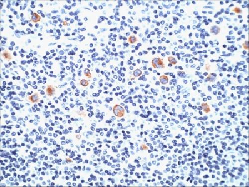 CD15 / FUT4 (Reed-Sternberg Cell Marker) Antibody
