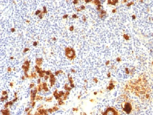 CD15 / FUT4 (Reed-Sternberg Cell Marker) Antibody