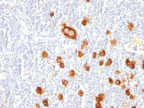 CD15 / FUT4 (Reed-Sternberg Cell Marker) Antibody