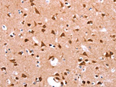 FUT8 Antibody