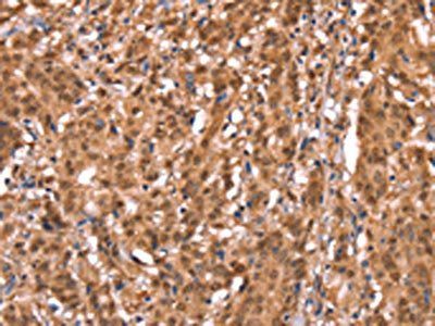 FXR1 Antibody