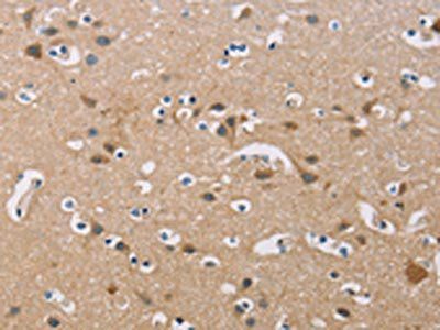 FXYD1 Antibody