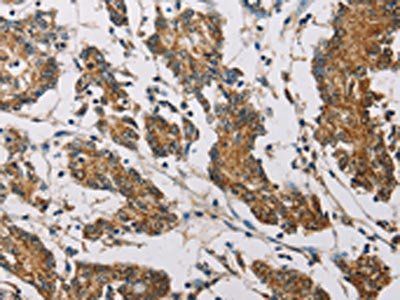 FXYD1 antibody