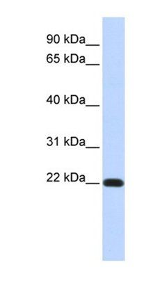 FXYD5 antibody