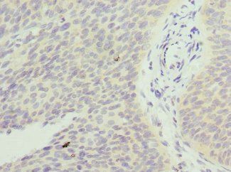 FXYD5 antibody