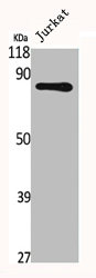 FYB antibody