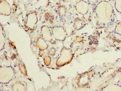 FYCO1 antibody