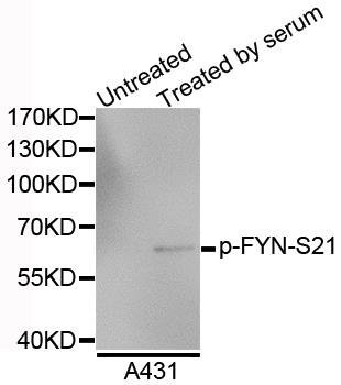 FYN (Phospho-S21) antibody