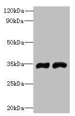 FYTTD1 antibody