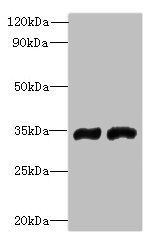 FYTTD1 Antibody
