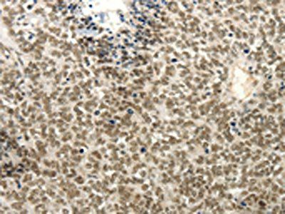 FZD10 antibody