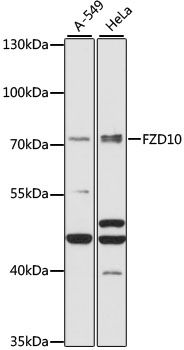 FZD10 antibody