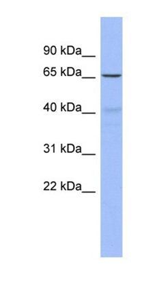 FZD2 antibody