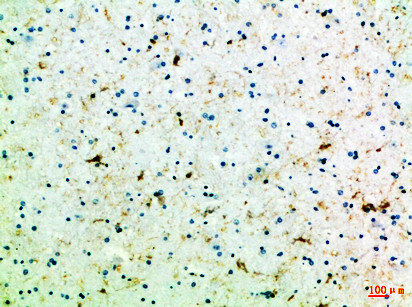 FZD4 antibody