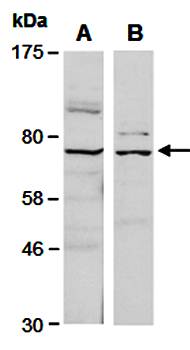 FZD8 (N) Antibody, Rabbit Polyclonal