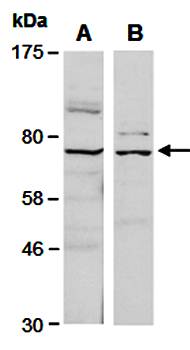 FZD8 antibody