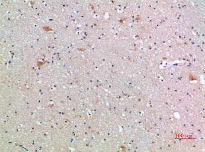 FZD9 antibody