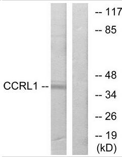 CCRL1 antibody