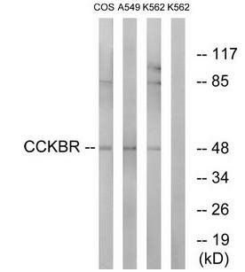 CCKBR antibody